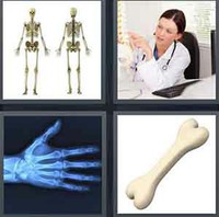 4 Pics 1 Word Bone